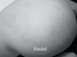 Heidel